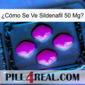 ¿Cómo Se Ve Sildenafil 50 Mgo 04